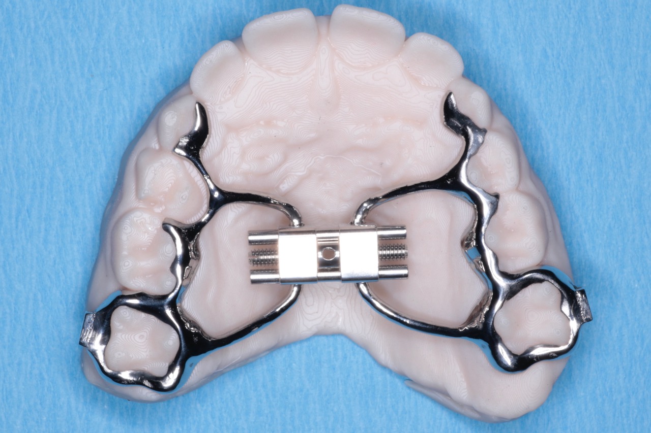 Ortodonzia intercettiva Dr. Matteo Meneghel